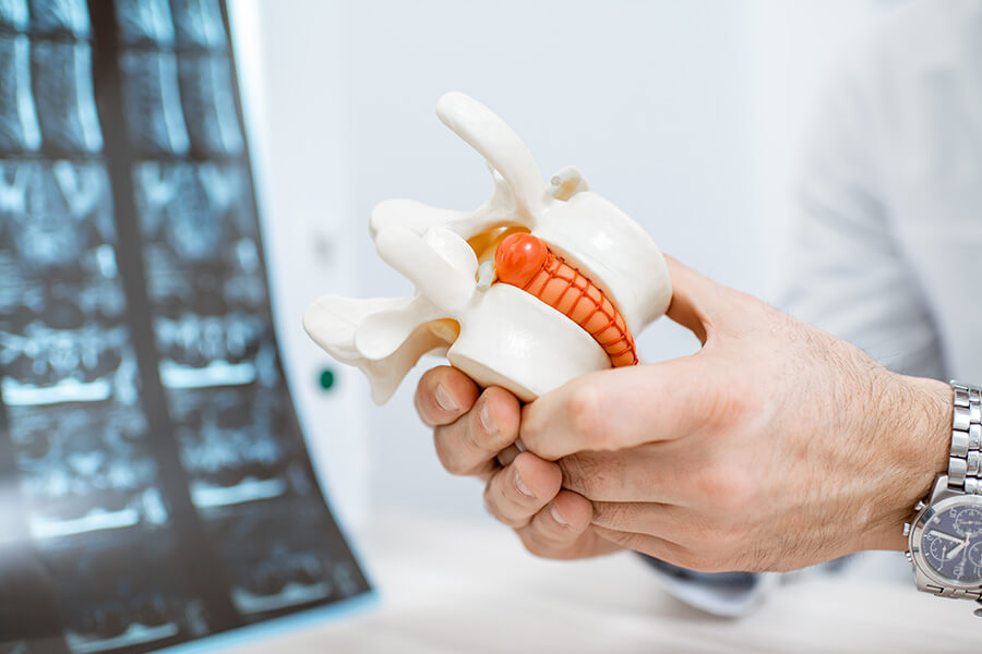 cirurgia de hernia de disco em cuiabá cirurgião especialista em coluna